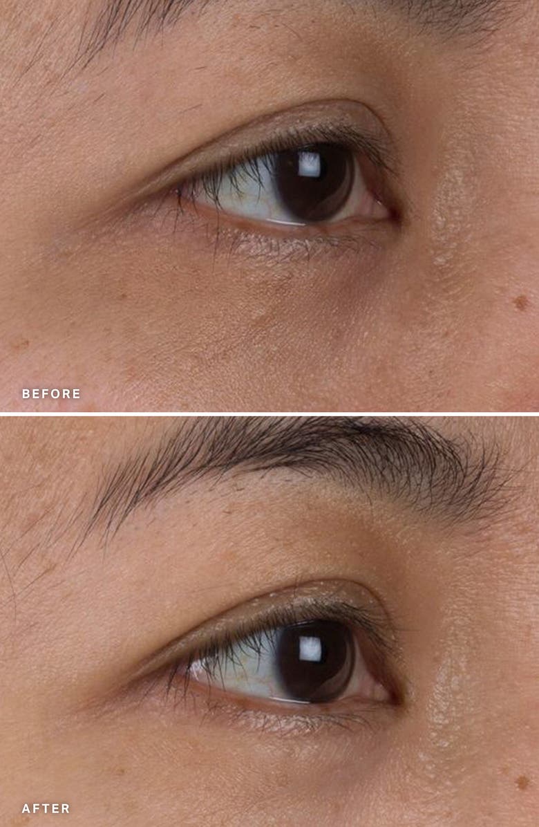 Alpha-H Liquid Gold<sup>™</sup> Firming Eye Cream, Alternate, color,