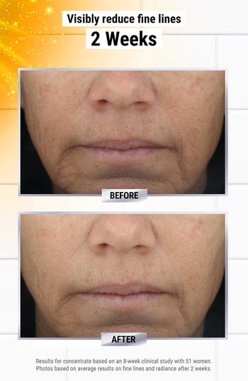 Powerful-Strength Line-Reducing Concentrate Serum $140 Value