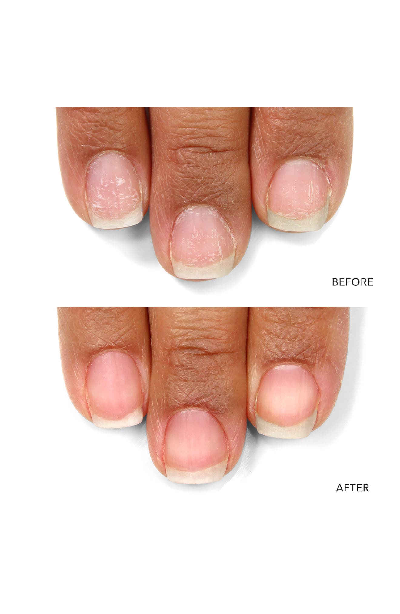 LONDONTOWN Nail Probiotic
