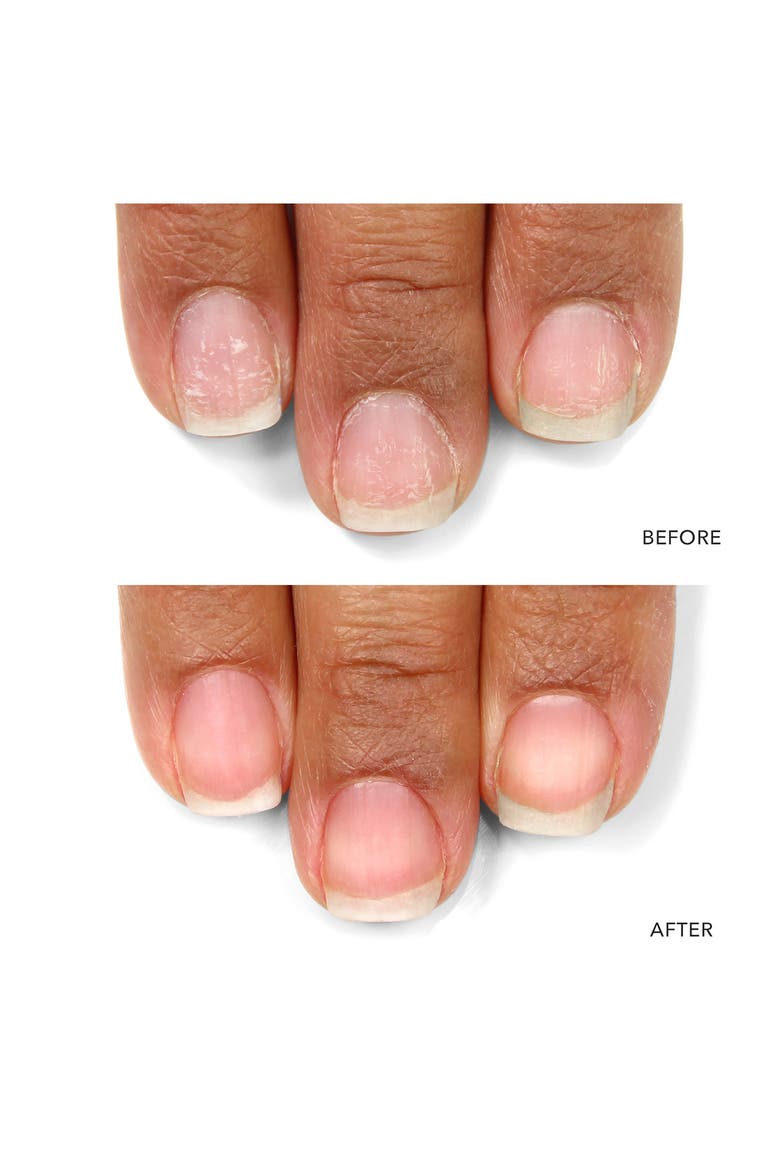 Nail Probiotic Instant Boost, Alternate, color, NO COLOR