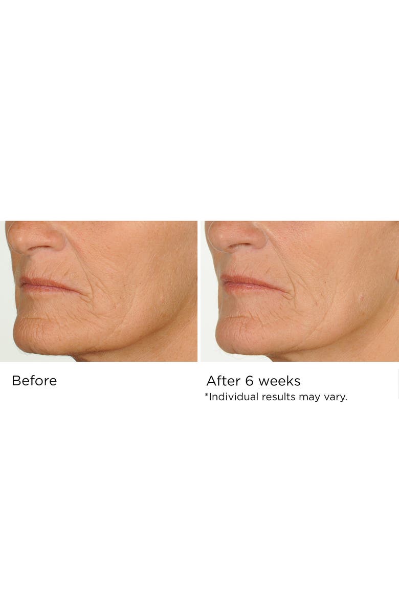 Dr. Nassif Skincare Night Therapy Serum 1oz, Alternate, color, NO COLOR