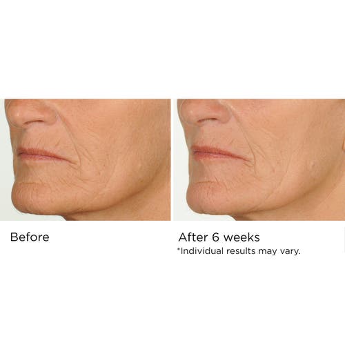 DR. NASSIF SKINCARE DR. NASSIF SKINCARE NIGHT THERAPY SERUM