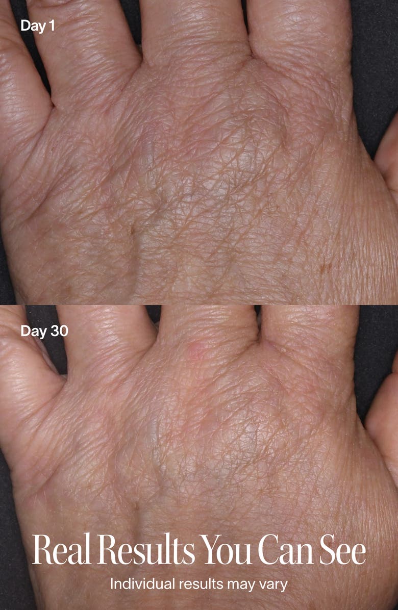 SolaWave 2-in-1 Skincare Mini LED Red Light Device, Alternate, color, Pink