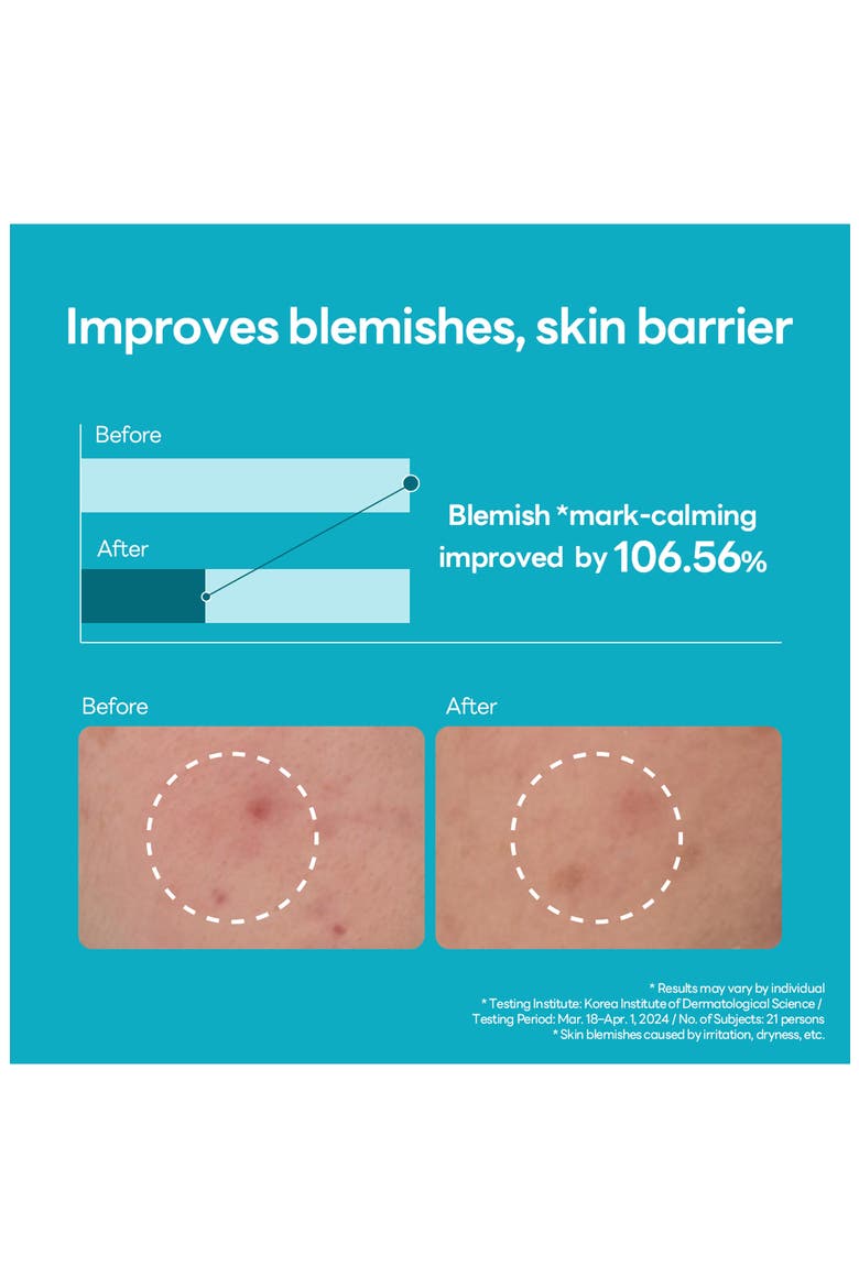 Madecassoside Blemish Repair Serum, Alternate, color, TURQUOISE/ AQUA
