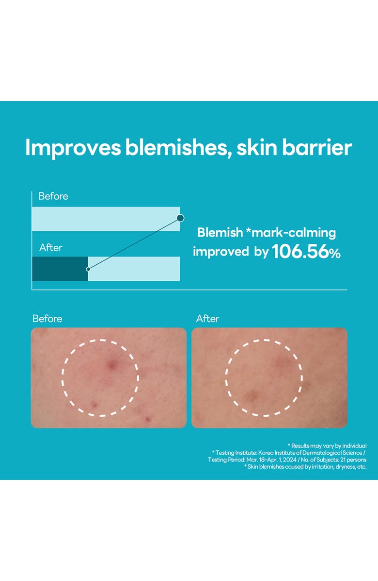 MEDIHEAL Madecassoside Blemish Repair Serum, Alternate, color, Turquoise/ Aqua