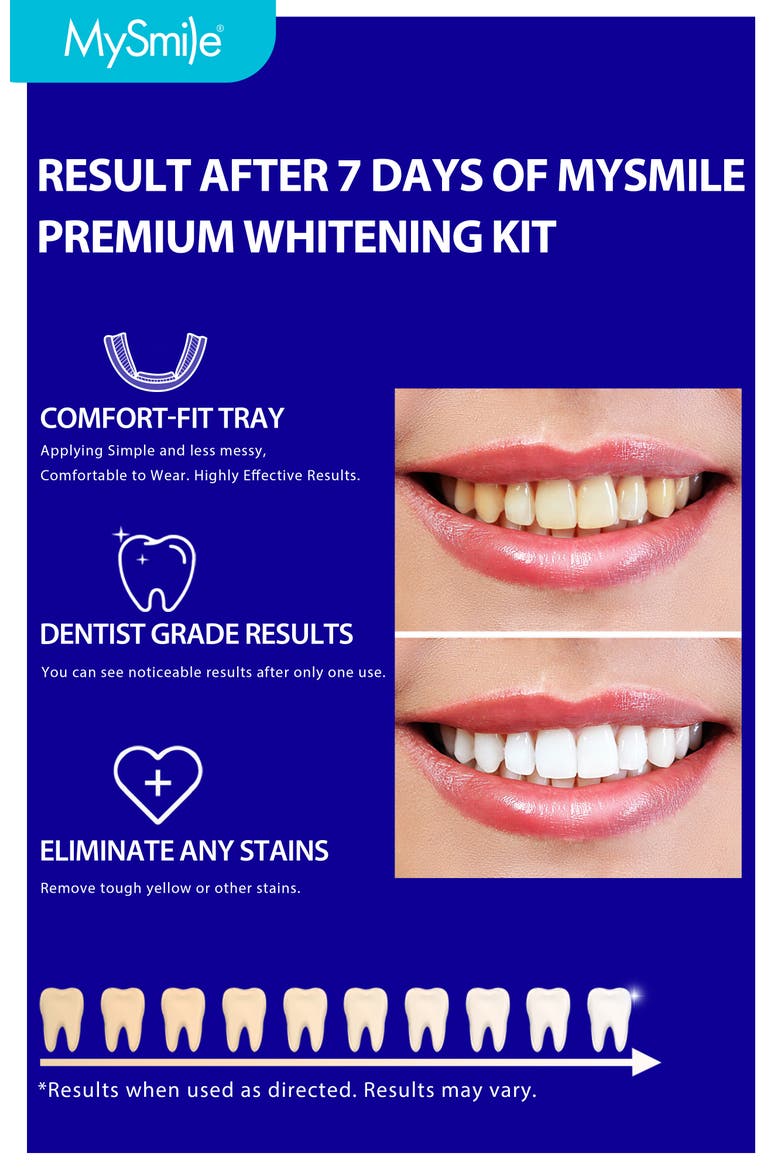 Prefilled Teeth Whitening Trays Kit, 12% Hydrogen Peroxide, Alternate, color, Purple