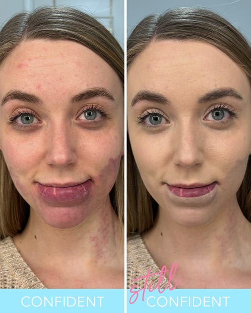 Doll 10 Beauty Tce This Corrects Everything Liquid Filter In Deep/rich