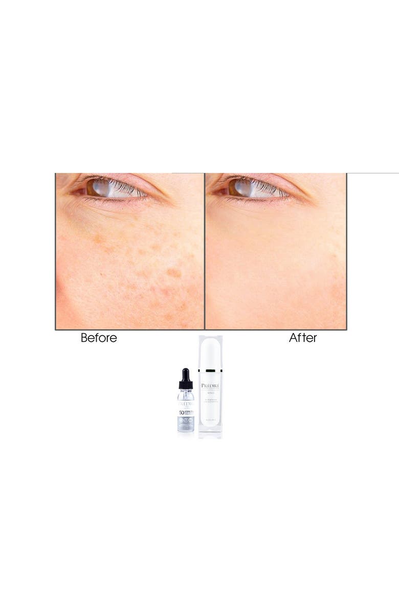 PREDIRE PARIS Intensive Apple & Grape Stem Cell Dark Spot Correction Set Powered by Bio Organica Technology, Main, color, 