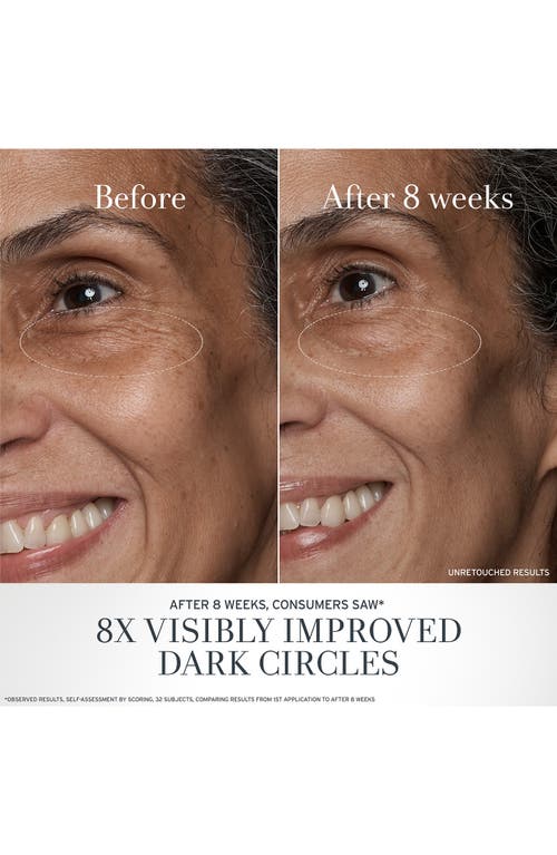 Fresh ® Black Tea Age Renewal Eye Duo (limited Edition) (nordstrom Exclusive) $144 Value In No Color