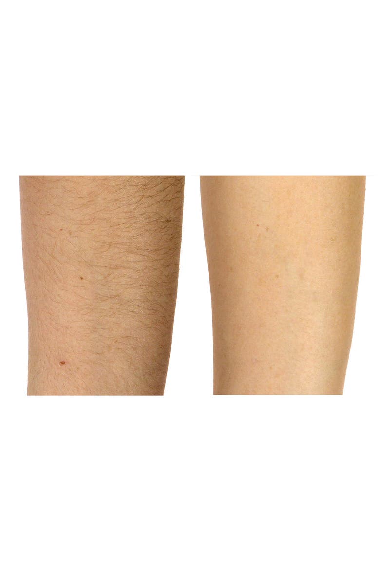 Flash & Go Express Hair Removal Device, Alternate, color, NO COLOR