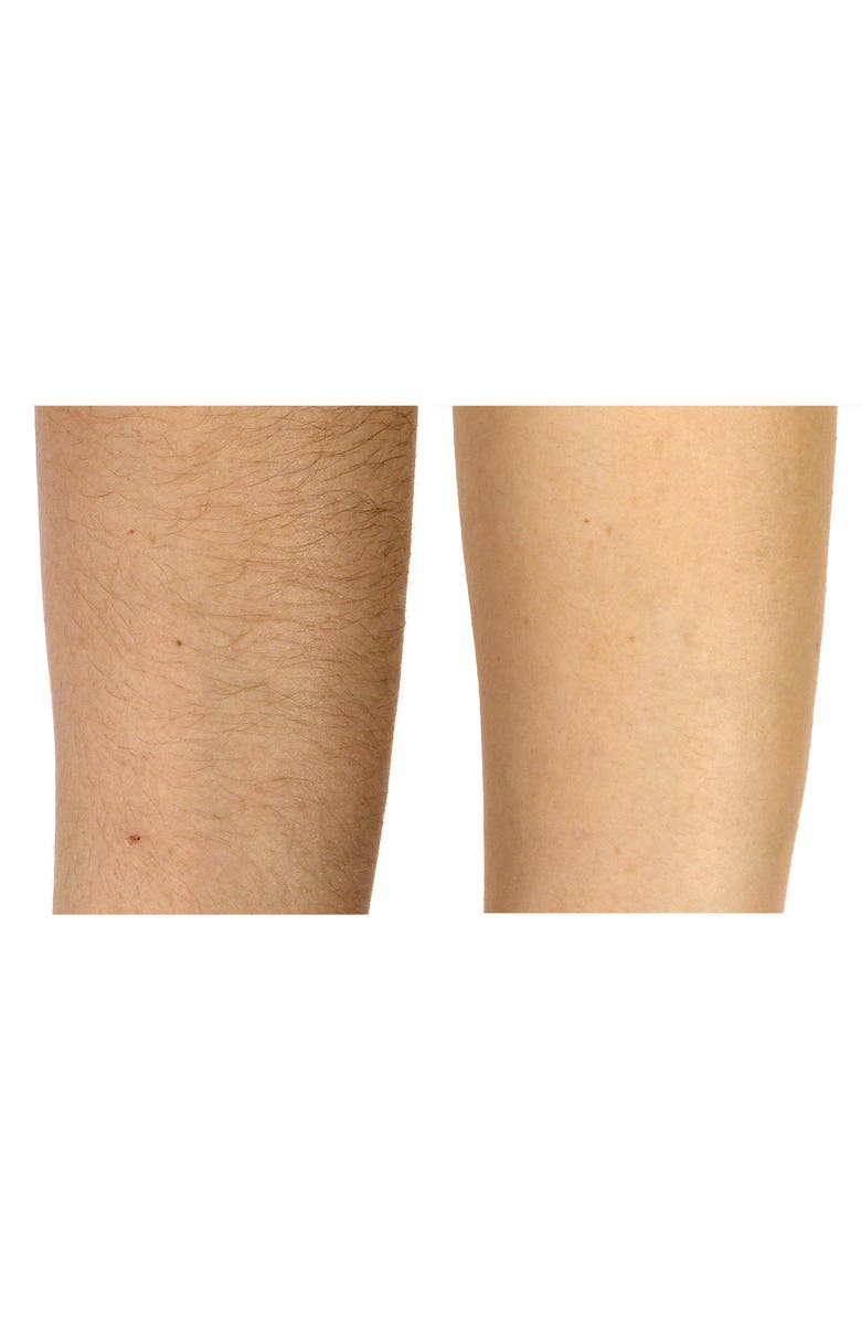 Silk'n Flash & Go Express Hair Removal Device, Alternate, color,