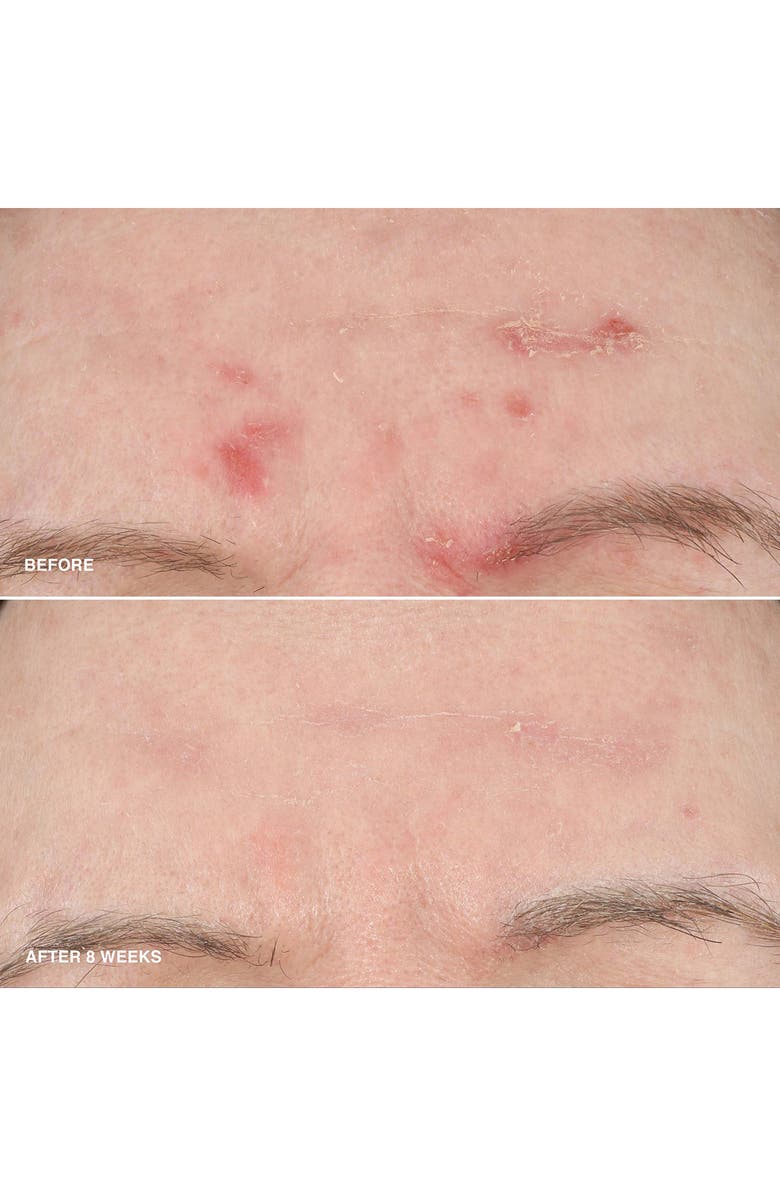 Vitamin Enriched Smoothing Serum Home & Away Duo $98 Value