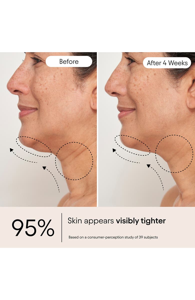 Alpyn Super Sculpt Serum for Face & Neck with Tri-Peptide Firming Complex, Alternate, color, 