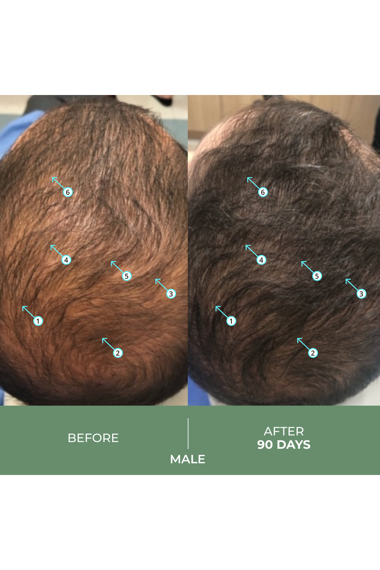 Spectral.CBD Hair Density Serum with CBD + Nanoxidil 5%, Alternate, color, No Color