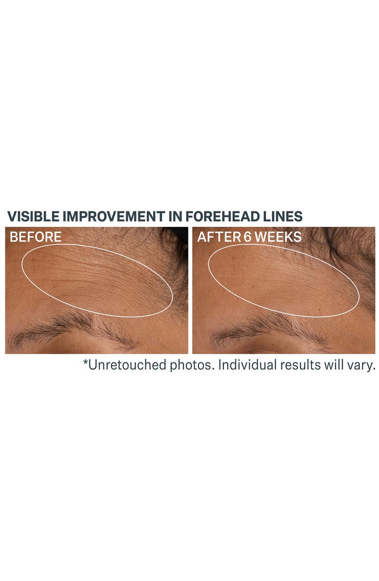 StriVectin<sup>®</sup> Advanced Retinol Daily Repair Moisturizer with SPF 30, Alternate, color,