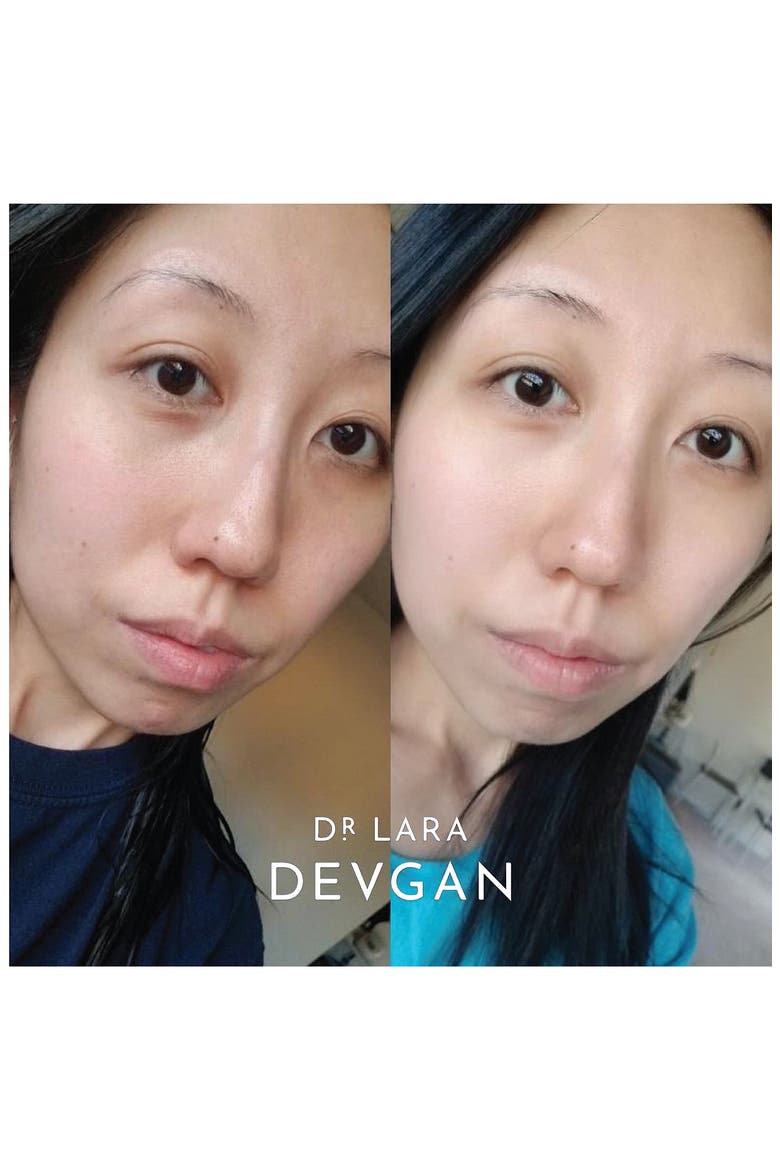 Hyaluronic Serum, Alternate, color, NO COLOR
