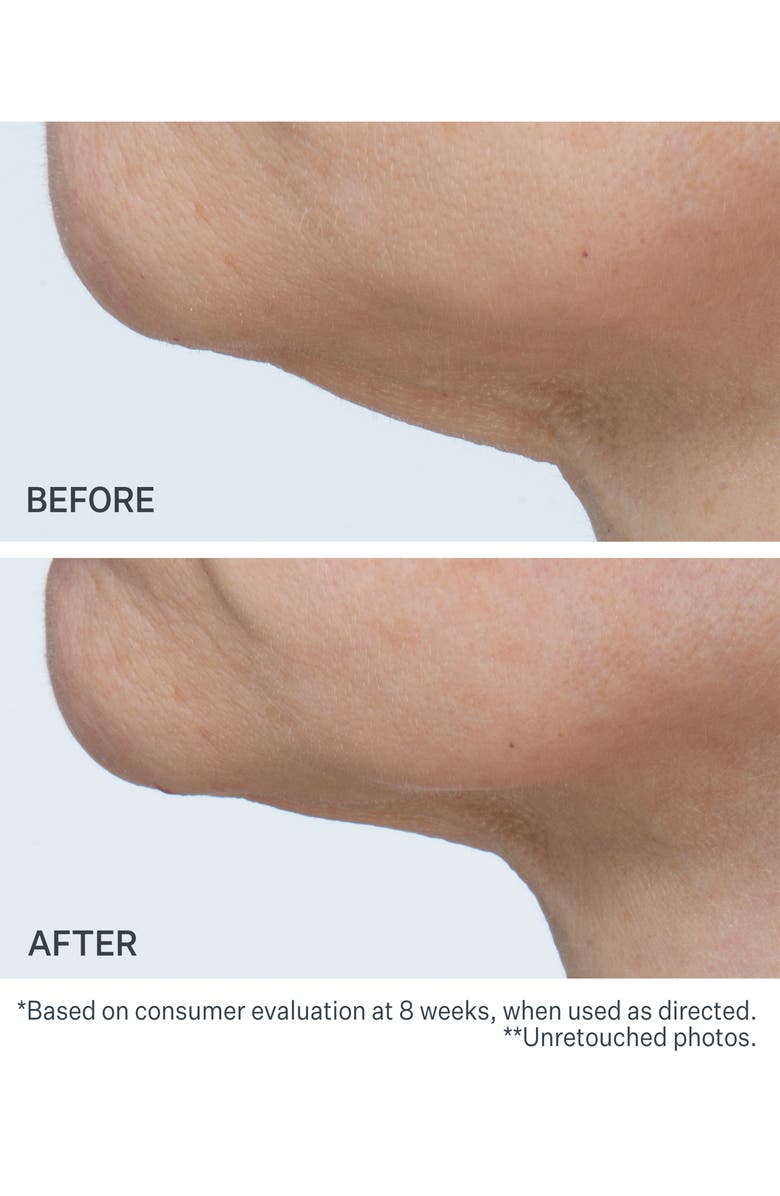 StriVectin<sup>®</sup> -TL<sup>™</sup> 'The Big Deal' Jumbo Advanced Tightening Neck Cream, Alternate, color, 