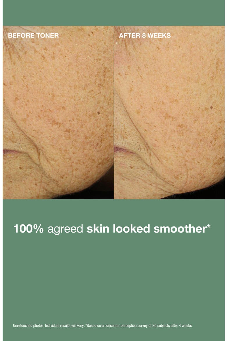 Daily Reveal Retexturizing Toner, Alternate, color, NO COLOR
