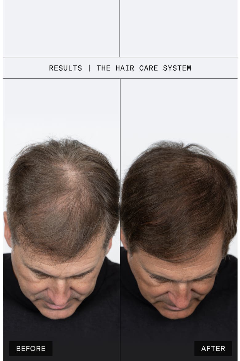 The Scalp + Hair Serum, Alternate, color, NO COLOR
