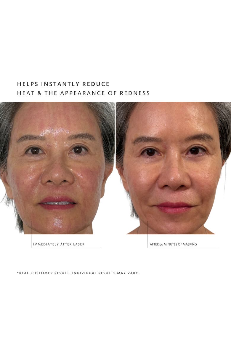 Thermoactivated Serum Gel Mask - 5 pack, Alternate, color, None