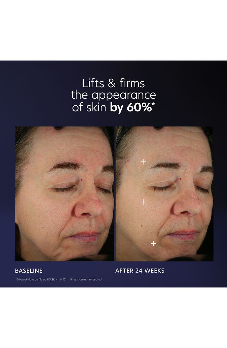 PCA Skin Pro-Max Age Renewal Serum, Alternate, color,