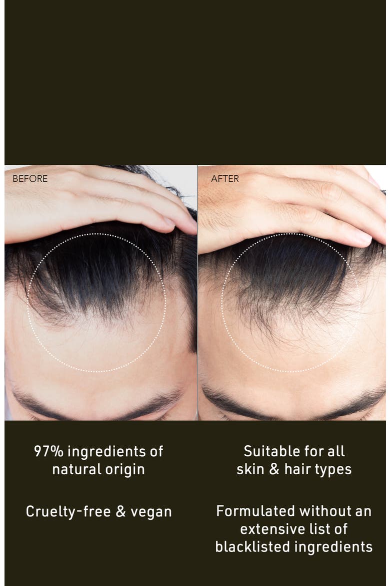 FAQ Scalp Recovery & Thick Hair Probiotic Serum, Alternate, color, NONE