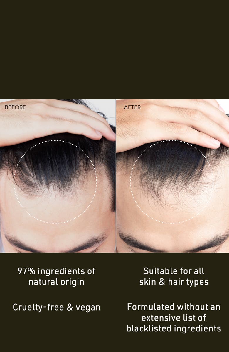 FOREO FAQ Scalp Recovery & Thick Hair Probiotic Serum, Alternate, color,