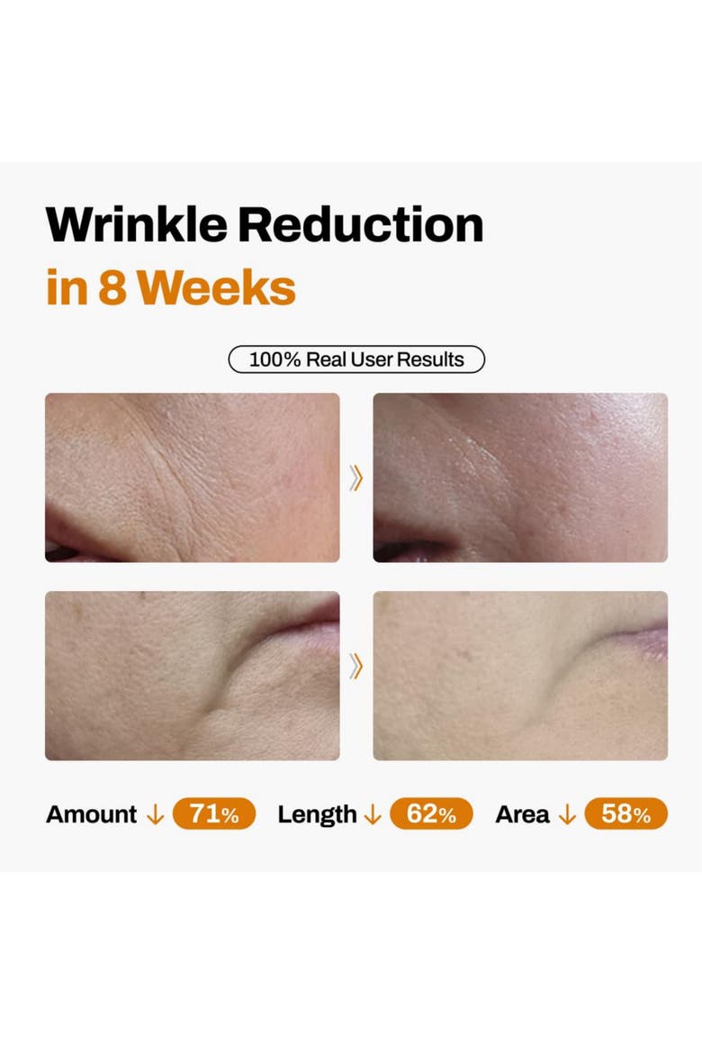 DermiShuttle Face Lifting Kit Women Daily Anti Wrinkle Care 8 Weeks, Alternate, color, No color