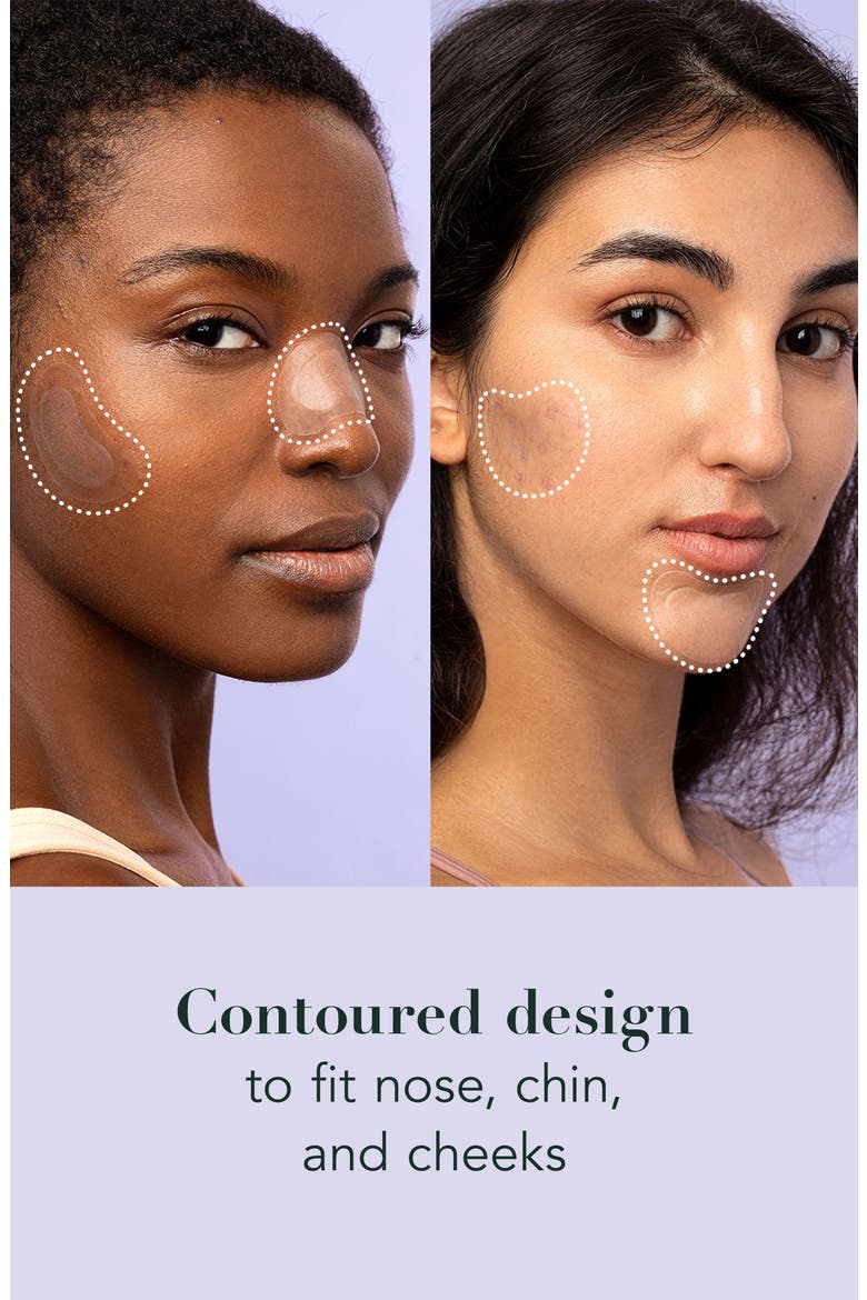 Miracle Patch Spot Control Acne Cover Patches, Alternate, color, NO COLOR