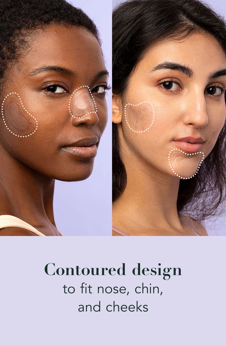 Rael Miracle Patch Spot Control Acne Cover Patches, Alternate, color,