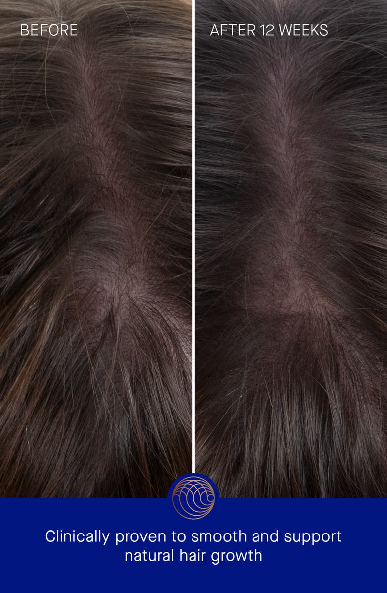 Augustinus Bader The Hair Oil, Alternate, color, 