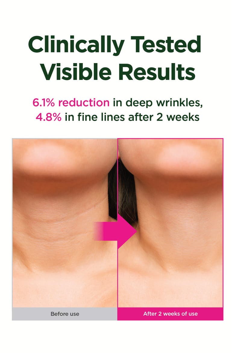 Retino Collagen Gua Sha Neck Cream Flexible Liposome 300, Alternate, color, NO COLOR
