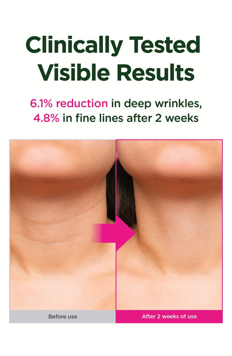 CKD Retino Collagen Gua Sha Neck Cream Flexible Liposome 300, Alternate, color, 