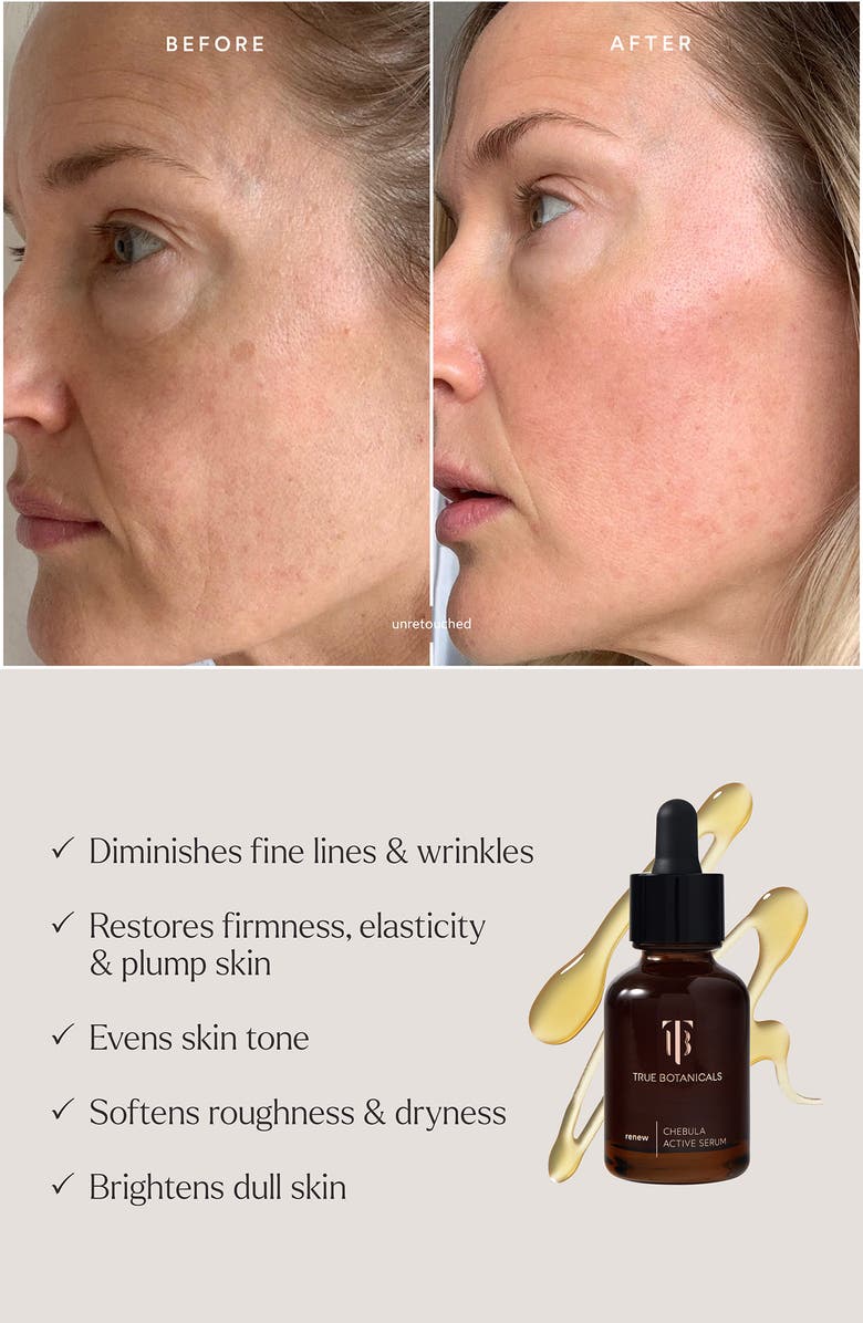 True Botanicals Radiance Rituals Day to Night Must Haves 4-Piece Skincare Kit (Limited Edition) (Nordstrom Exclusive) $312 Value, Alternate, color,