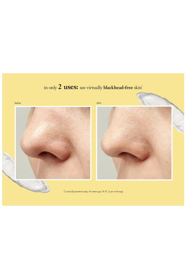 purity made simple pore extractor mask, Alternate, color, NO COLOR