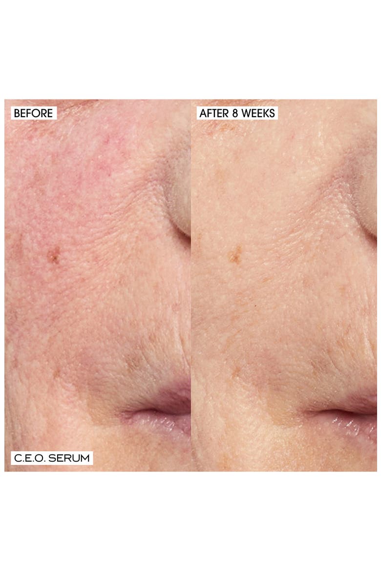 Home & Away Brighten, Revitalize & Glow C.E.O. Serum Duo (Limited Edition) $135 Value, Alternate, color, NO COLOR