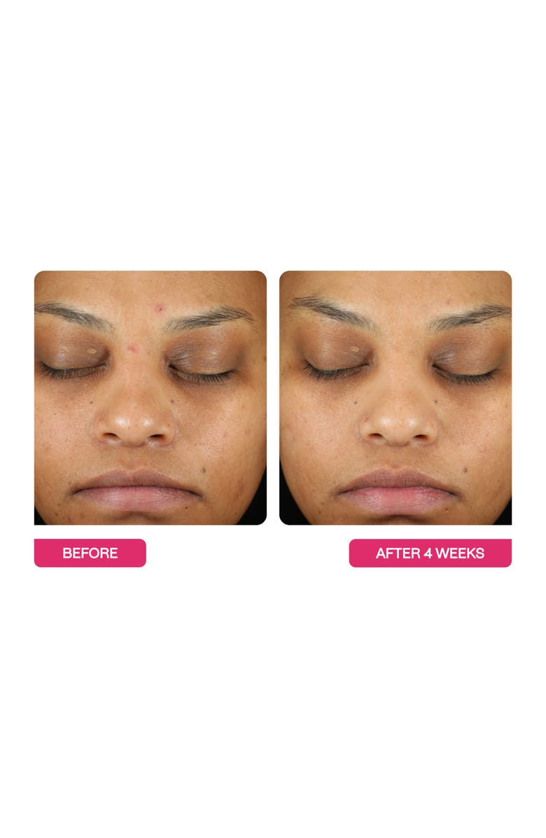 BeautyStat Universal Triple Action Peel Pads 10-Pack, Alternate, color,