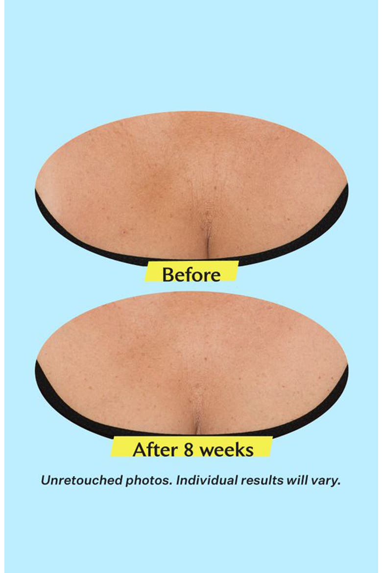 TL Advanced Tightening Neck Cream, Alternate, color, NO COLOR