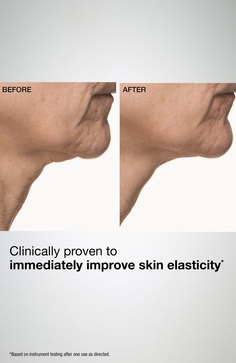 StriVectin<sup>®</sup> TL Advanced<sup>™</sup> Sculpting Neck & Jawline Mask, Alternate, color,