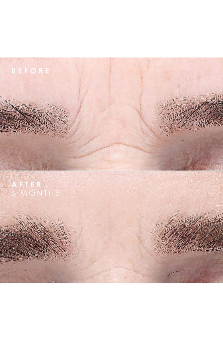 BIOEFFECT Imprinting Hydrogel Mask & EGF Face Serum Set, Alternate, color, 