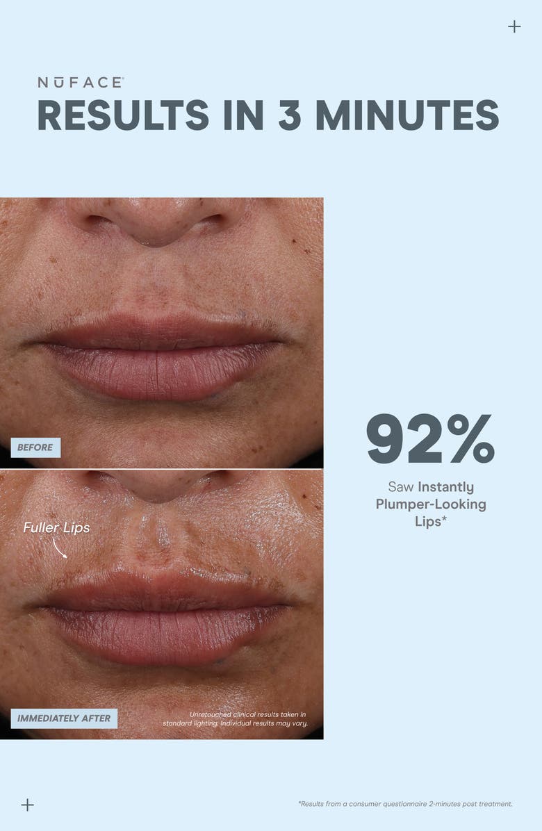 NuFACE<sup>®</sup> FIX MicroWand Targeted Microcurrent Device for Eyes, Lips & Lines $244 Value, Alternate, color, White