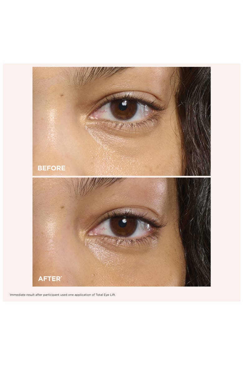 Total Eye Lift Refillable Eye Cream for Firming, Wrinkles, Dark