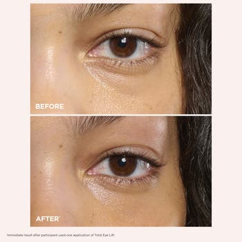 Clarins Total Eye Lift Refillable Eye Cream for Firming, Wrinkles