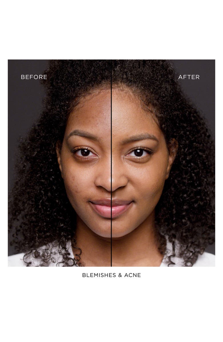 Lancôme Teint Idole Ultra Wear All Over Concealer, Alternate, color, 460 Suede W