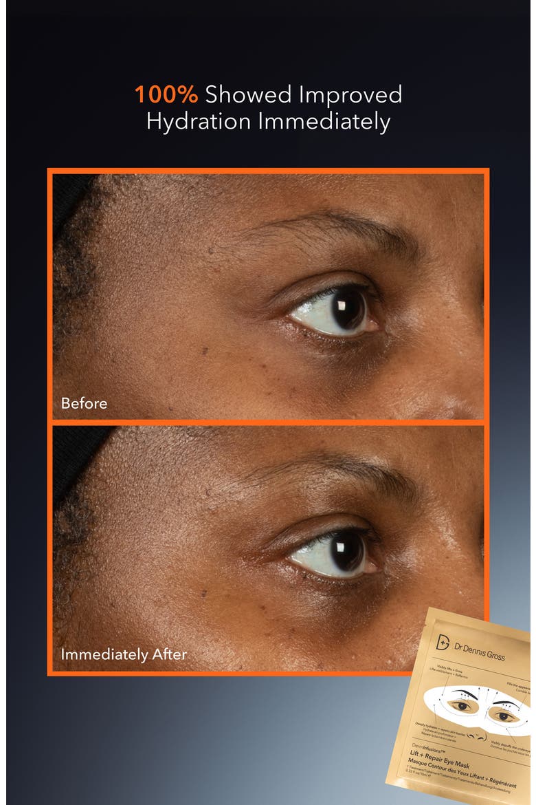 DermInfusions Lift + Repair Eye Mask, Alternate, color, NO COLOR