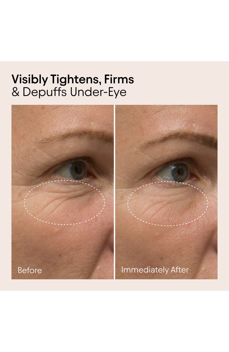 Alpyn Line-Filling Eye Balm, Alternate, color,