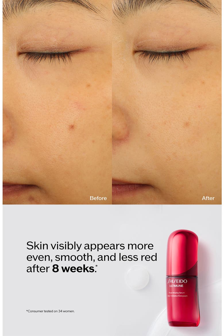 Ultimune Power Infusing Serum, Alternate, color, REGULAR