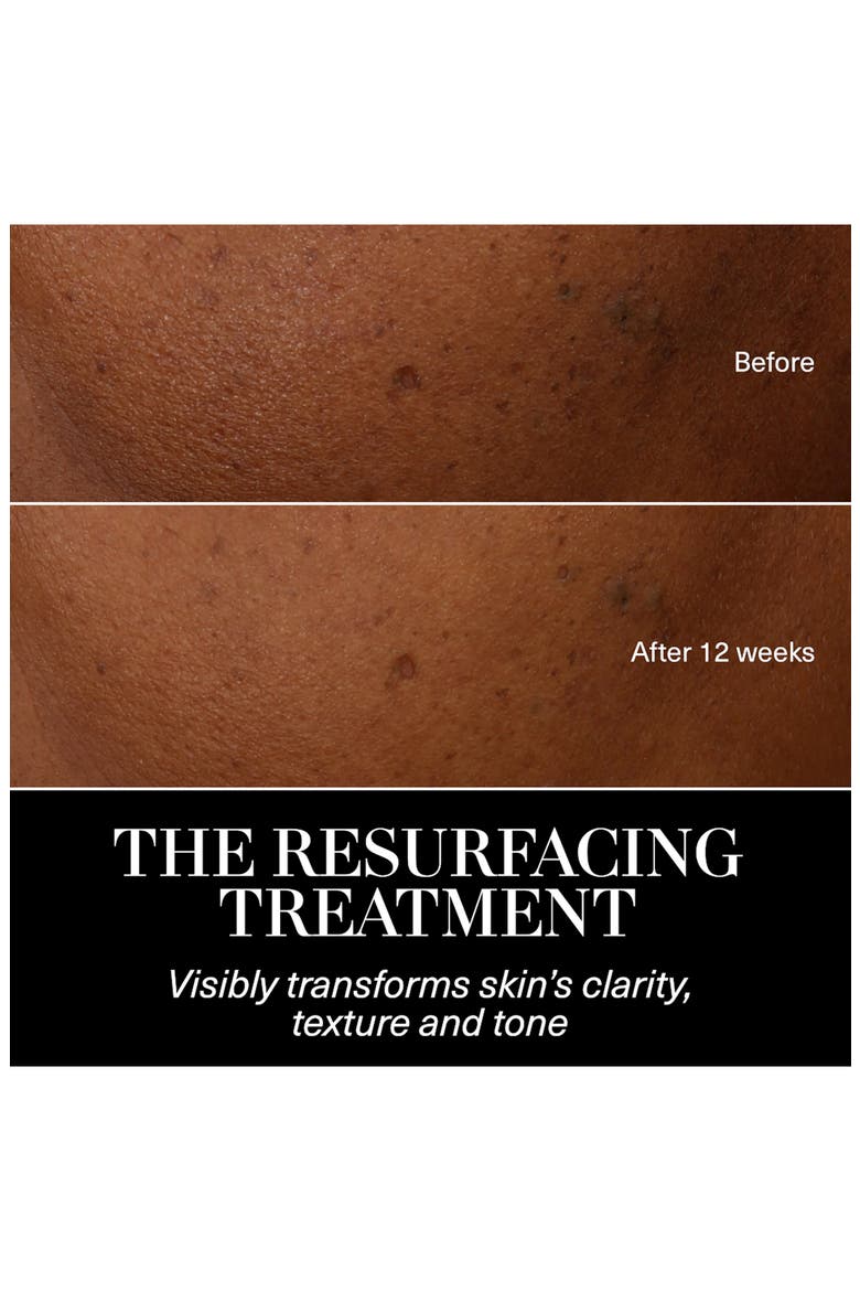 The Resurfacing Treatment Exfoliator for Clarifying & Smoothing, Alternate, color, NO COLOR