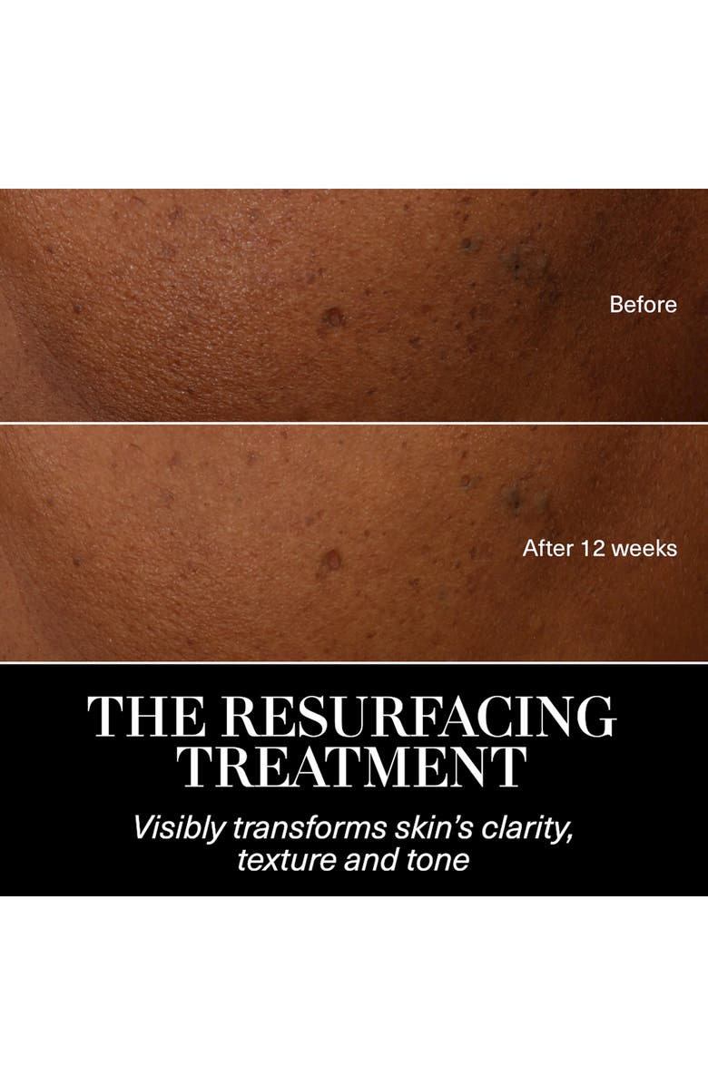 La Mer The Resurfacing Treatment Exfoliator for Clarifying & Smoothing, Alternate, color, 