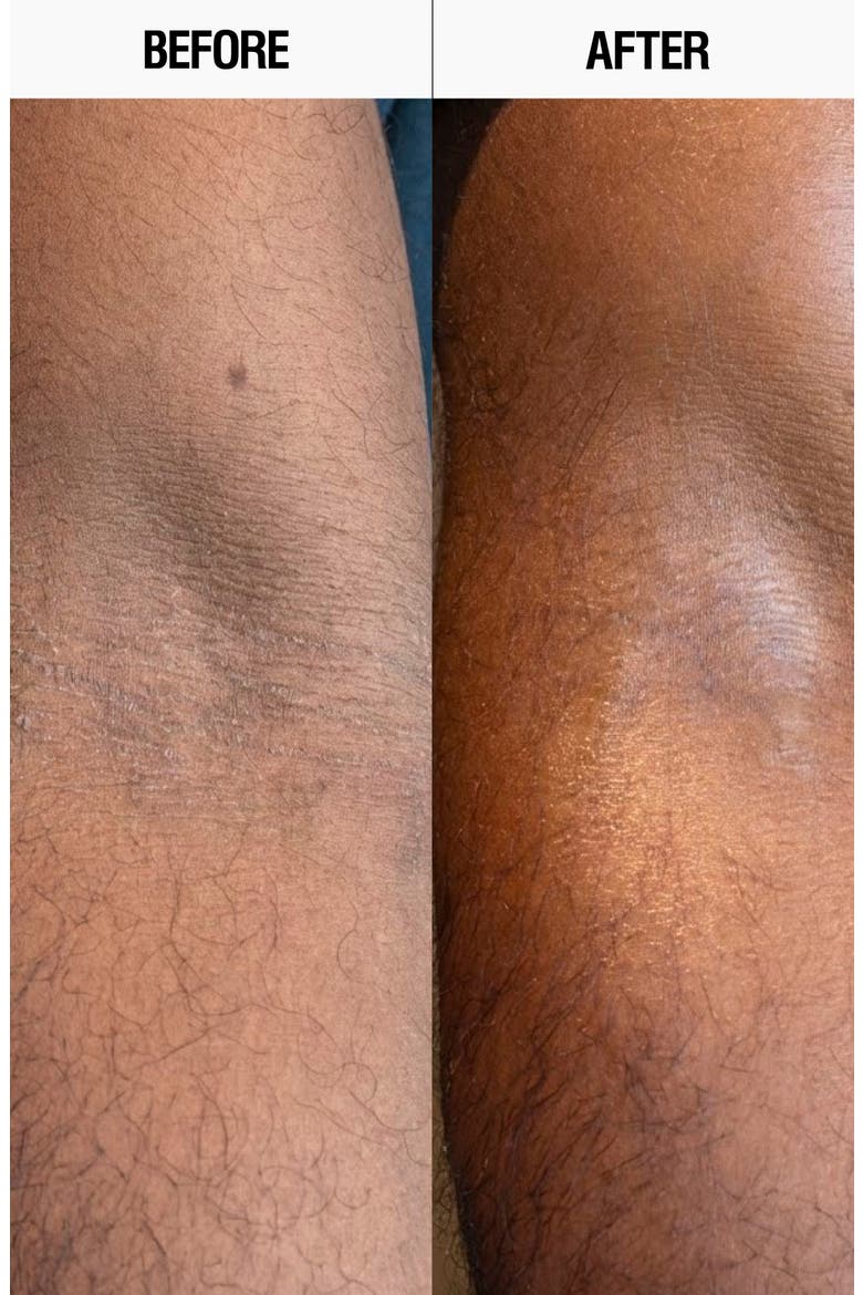 Resurfacing Targeted Body Lotion, Alternate, color, NO COLOR